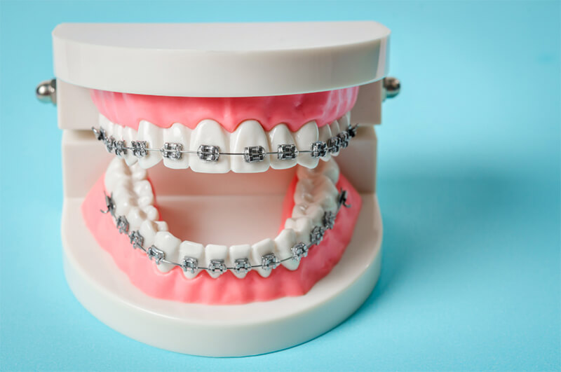 Benefits: Healthy Smiles